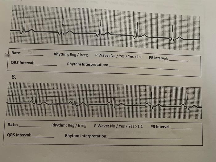 Rate Rhythm Reg Irreg P Wave No Yes Yes 1 1 Pr Interval Qrs Interval Rhythm Interpretation 8 Rate Rhythm R 1