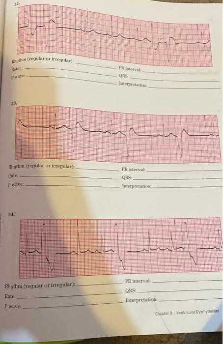 32 Southm Regular Or Irregular Wave Perval Qis Boerpectation Rhythm Regular Or Irregular Fate Pr Interval Pwave Qrs 1