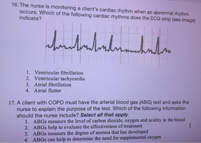 16 The Nurse Is Monitoring A Client S Cardiac Rhythm When An Abnormal Rhythm Occurs Which Of The Following Cardiac Rhy 1