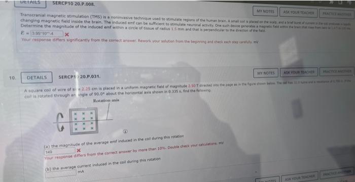 Details Sercp10 20 P 008 My Notes Ask Your Teacher Transcranial Magnetic Stimulation Tms Is A Noninvasive Technique U 1