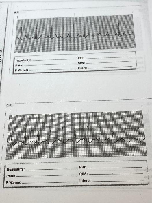 Indentatehenden Pri Rogularity Rate P Waves Qrs Interp 4 6 1 Regularity Rate Pri Qrs Interp P Waves 1