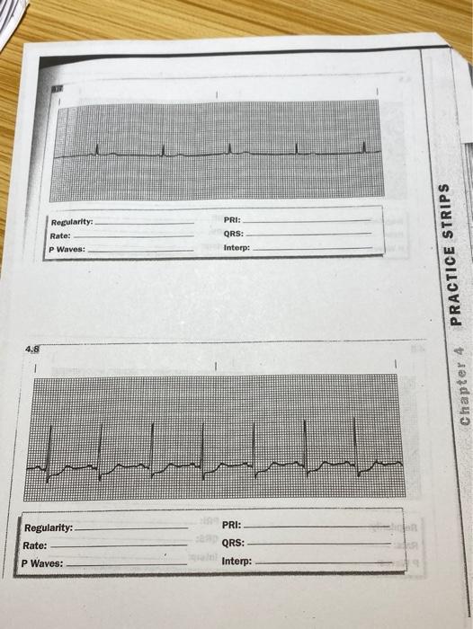 Regularity Rate P Waves Pri Qrs Interp Practice Strips 4 8 Chapter 4 Regularity Rate Pri Qrs Interp P Waves 1