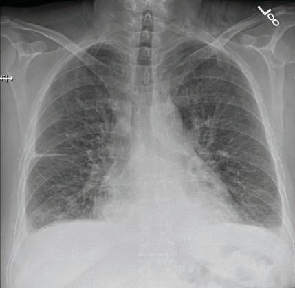 Cardiac Failure Case Study 3 Based On The Patient Documented Information In Their Chart Below Provide Requested In 1