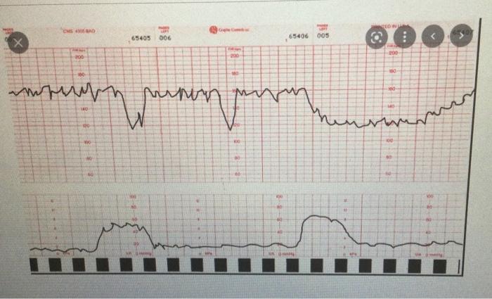 Activity Description Victoria Smith Is A 28 Year Old Gravida 2 Para 1 Who Presented To The Labor And Delivery Area A Fe 1