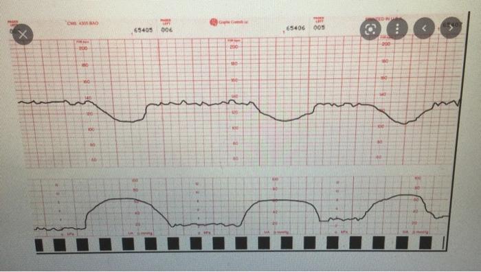 Activity Description Monica Jackson Is A 35 Year Old Gravida 3 Para 2 She Is 39 Weeks Gestation She Arrived To The La 1