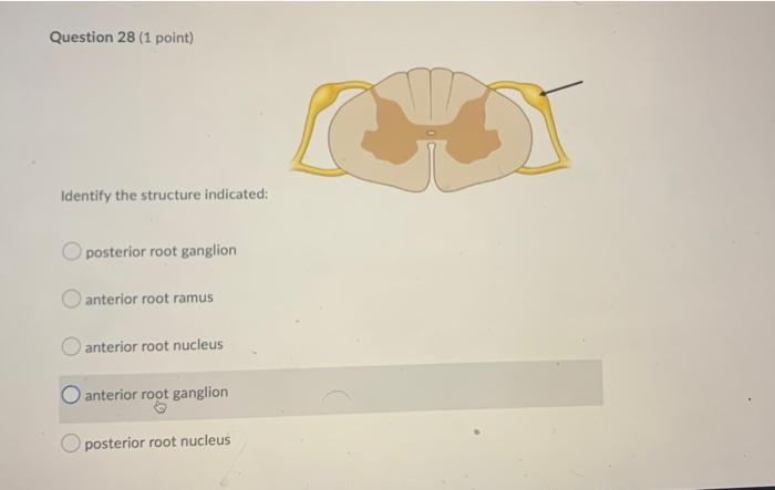 Question 28 1 Point Identify The Structure Indicated Posterior Root Ganglion Anterior Root Ramus Anterior Root Nucleu 1