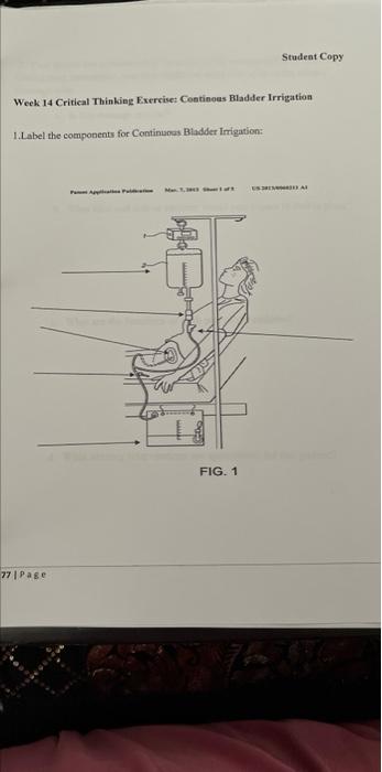 Student Copy Week 14 Critical Thinking Exercise Continous Bladder Irrigation 1 Label The Components For Continuous Blad 1