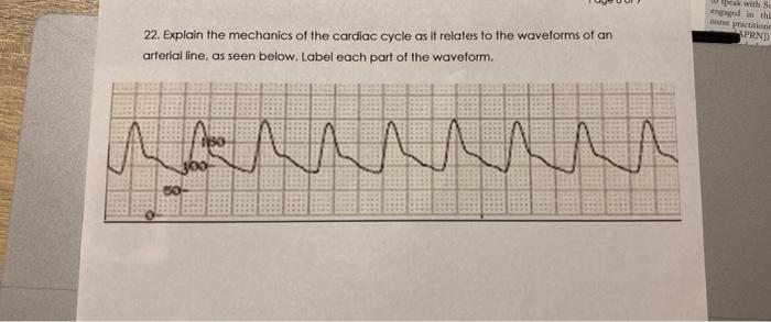 Speak With Se End Is The Practition Prni 22 Explain The Mechanics Of The Cardiac Cycle As It Relates To The Waveforms 1