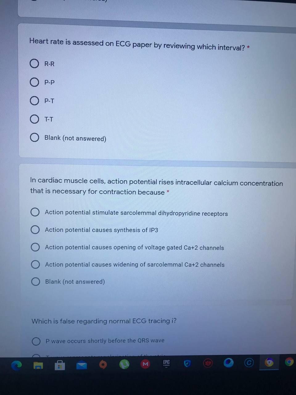 Heart Rate Is Assessed On Ecg Paper By Reviewing Which Interval R R P P P T T T Blank Not Answered In Cardiac Muscle 1