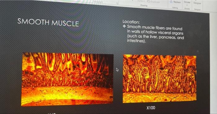 Neurogalia Location Found In The Central Nervous System And Peripheral Nervous System 99 X40 X100 Smooth Muscle Loca 2