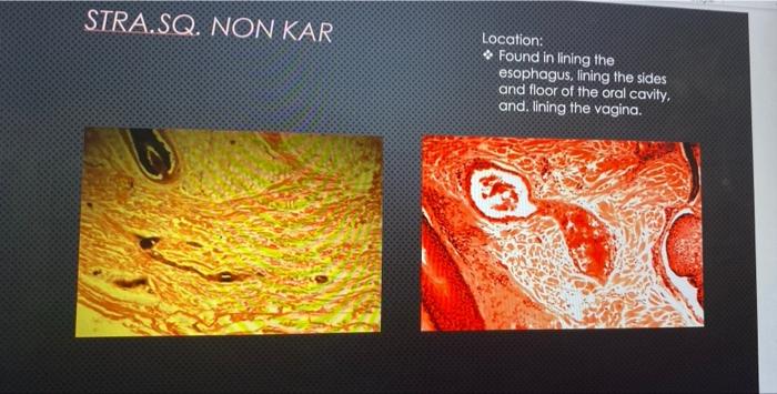 Neurogalia Location Found In The Central Nervous System And Peripheral Nervous System 99 X40 X100 Smooth Muscle Loca 3