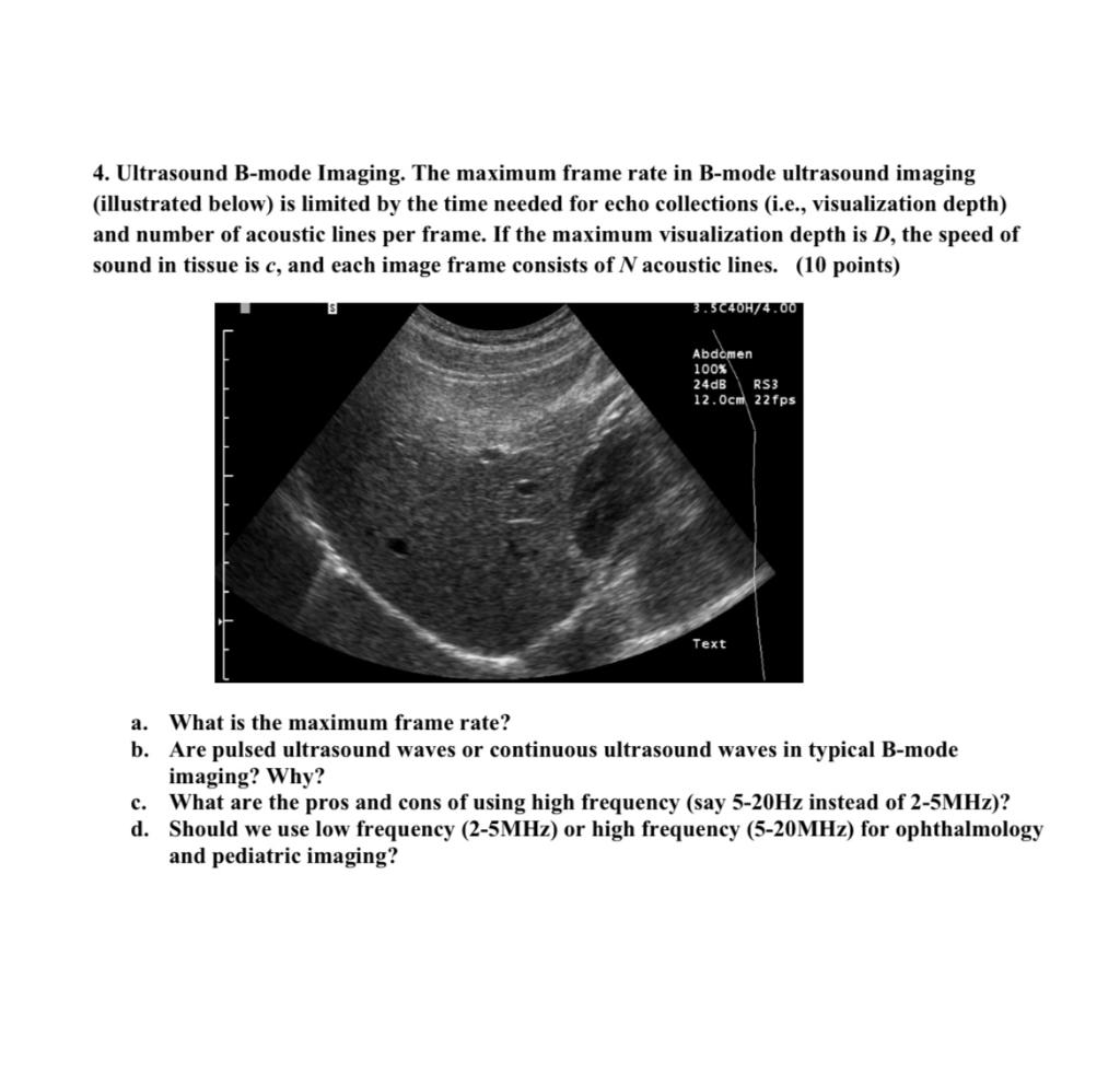 4 Ultrasound B Mode Imaging The Maximum Frame Rate In B Mode Ultrasound Imaging Illustrated Below Is Limited By The 1