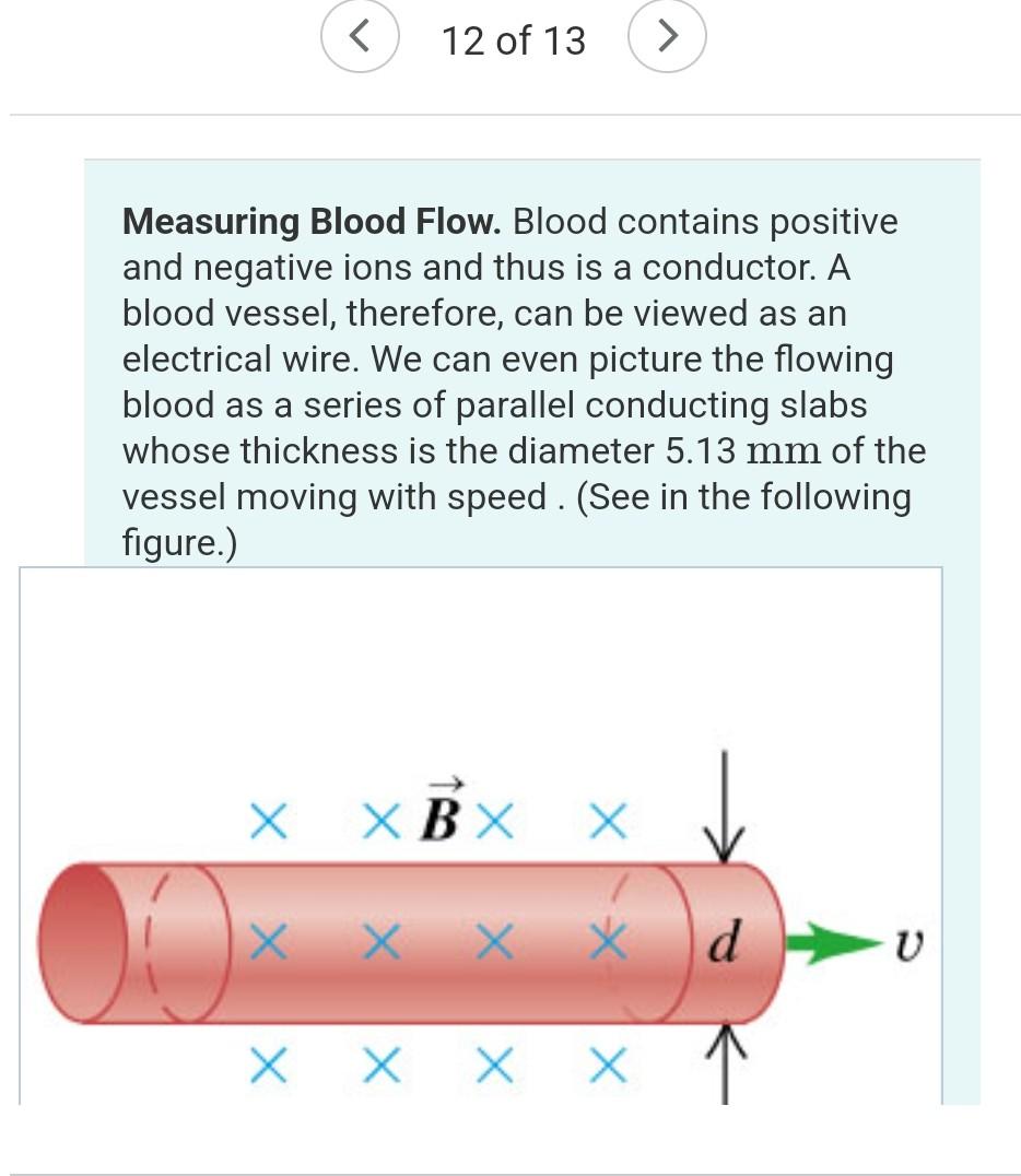 12 Of 13 Measuring Blood Flow Blood Contains Positive And Negative Ions And Thus Is A Conductor A Blood Vessel Th 1