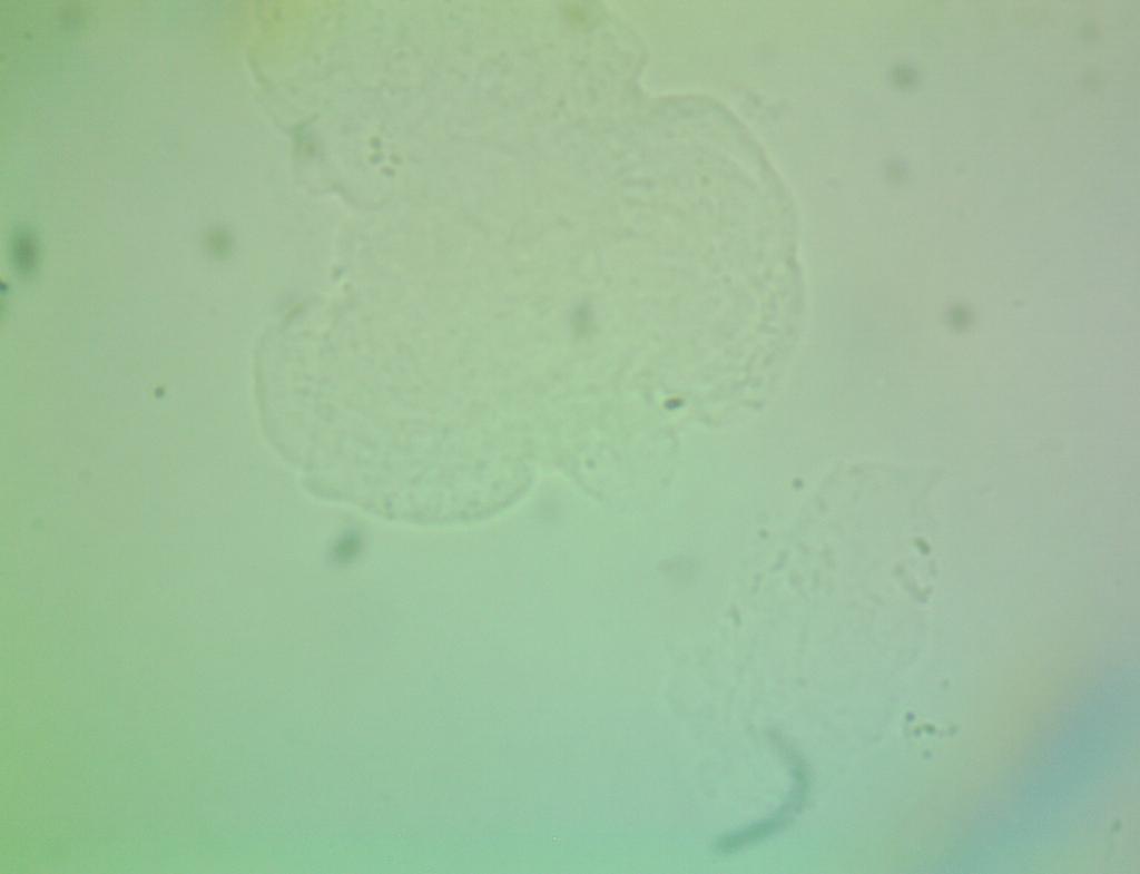 Can Someone Label And Show Me On The Images All The Organelles And Bacteria That Can Be Seen In These Three Different Pi 1
