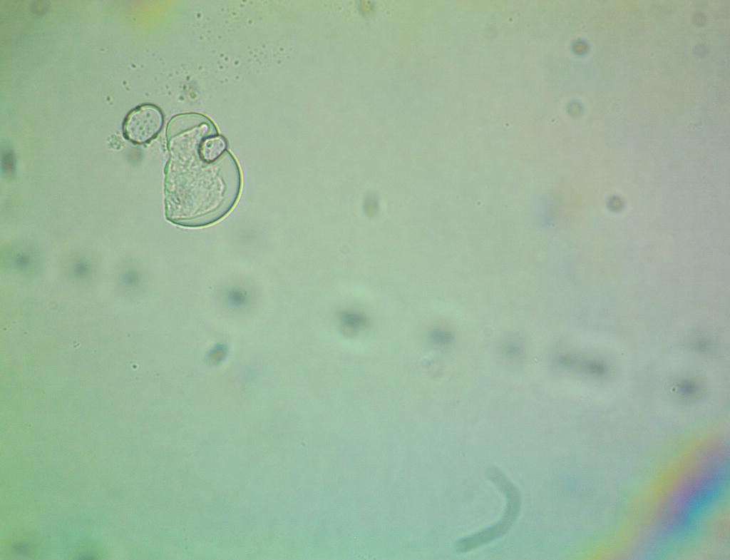 Can Someone Label And Show Me On The Images All The Organelles And Bacteria That Can Be Seen In These Three Different Pi 2