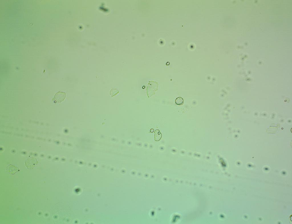 Can Someone Label And Show Me On The Images All The Organelles And Bacteria That Can Be Seen In These Three Different Pi 3