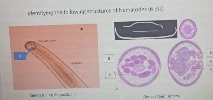 Identifying The Following Structures Of Nematodes 6 Pts B M C Genus Clue Ancylostoma Genus Clue Ascaris 1