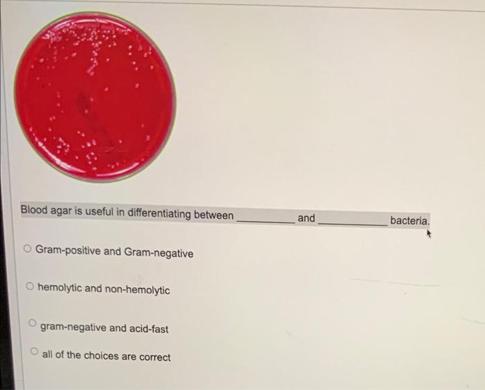 Blood Agar Is Useful In Differentiating Between And Bacteria Gram Positive And Gram Negative O Hemolytic And Non Hemoly 1