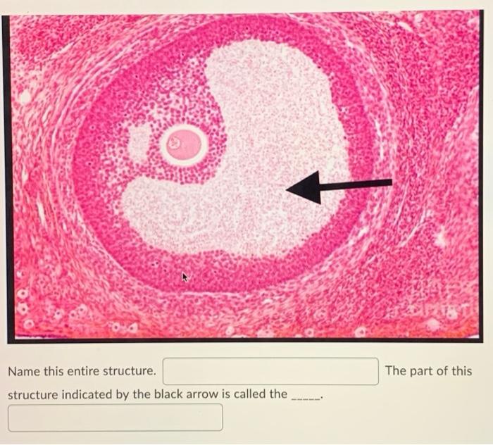 The Part Of This Name This Entire Structure Structure Indicated By The Black Arrow Is Called The 1