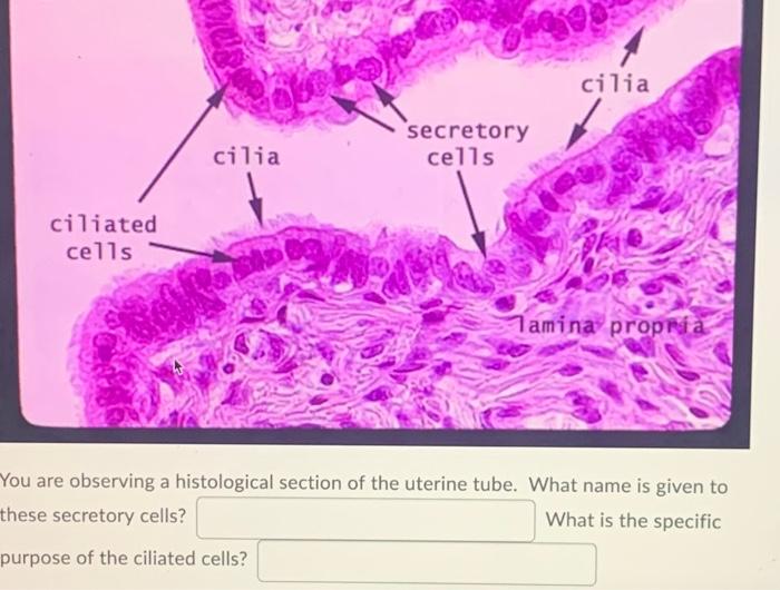 And Cilia Bebo Secretory Cells Cilia Ciliated Cells Tamina Propria You Are Observing A Histological Section Of The Uteri 1