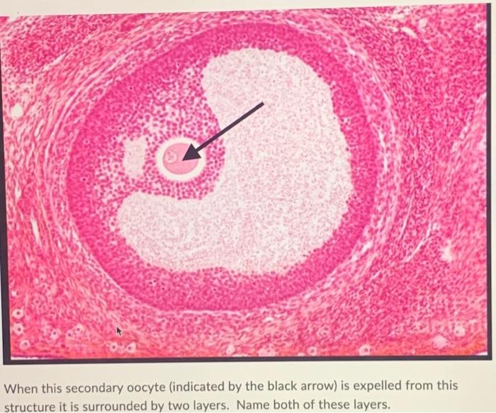 When This Secondary Oocyte Indicated By The Black Arrow Is Expelled From This Structure It Is Surrounded By Two Layers 1