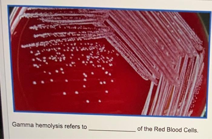 Sogasa Gamma Hemolysis Refers To Of The Red Blood Cells 1
