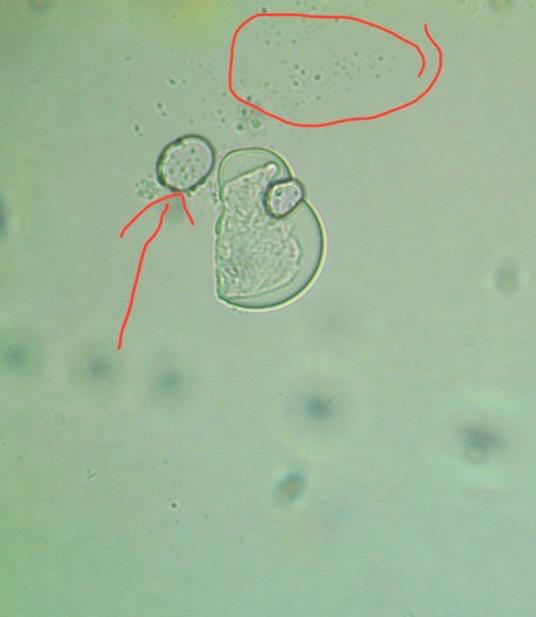 This Is Human Cheek Cell Under The Microscope What Are These In Arrow And The Circle Show Below 1