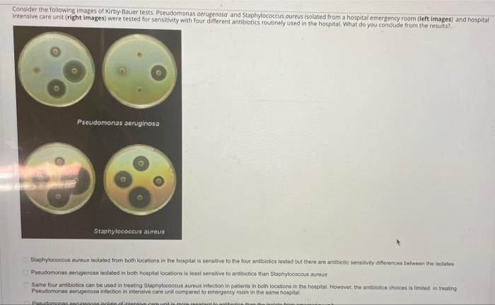 Consider The Following Images Of Kirby Bauer Tests Pseudomonas Aerugenosa And Staphylococcus Aureus Isolated From A Hos 1