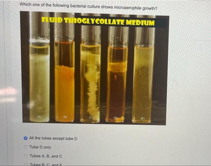 Which One Of The Following Bacterial Culture Shows Microaerophile Growth Fluid Thioglycollate Medium A B C E Al 1