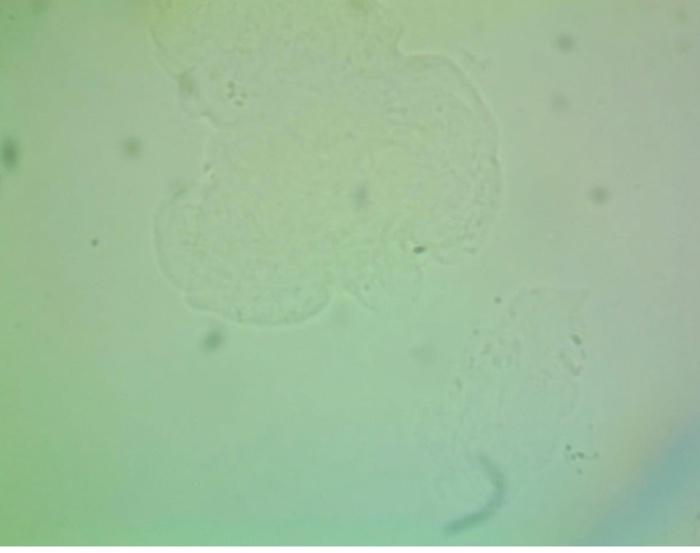 Can You See The Nucleus Cytoplasm And Cell Membrane In This Image Of Cheek Cell X100 And Can You Label Them 1