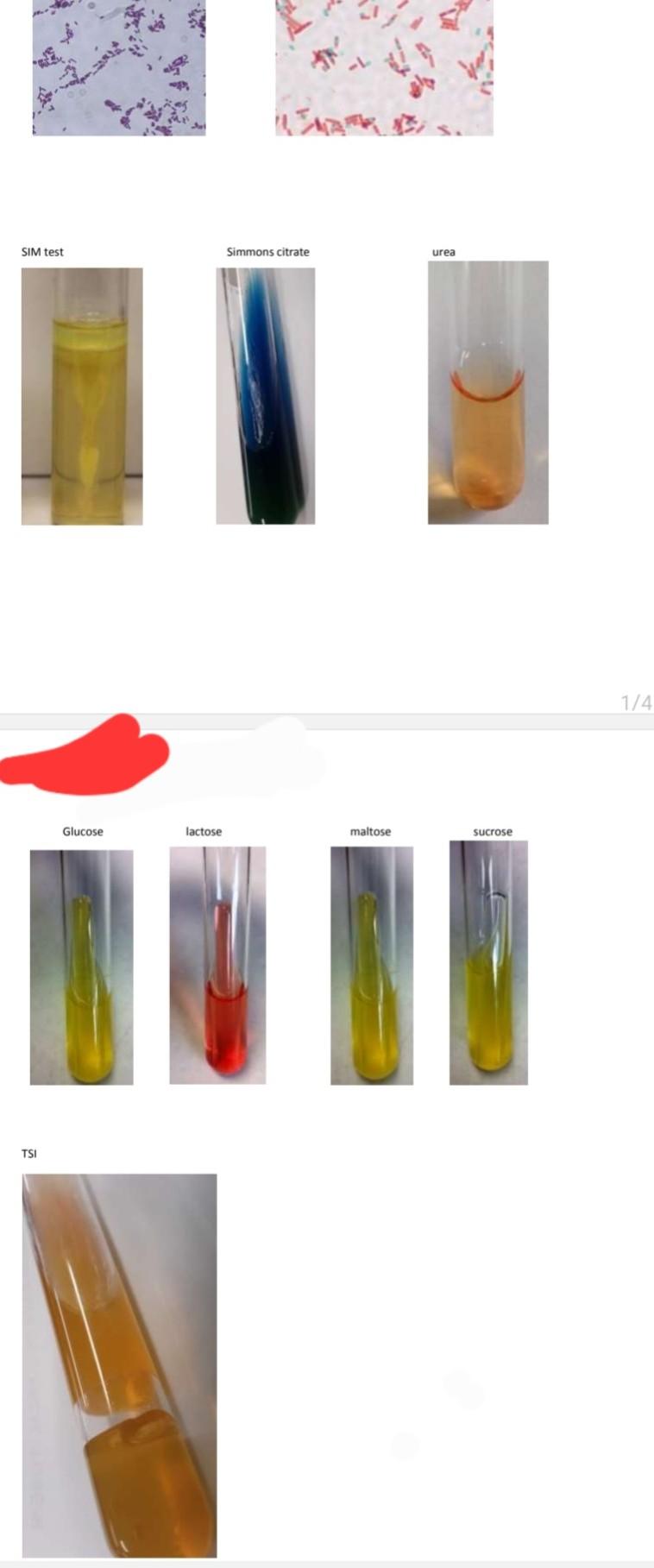 Ya Sim Test Simmons Citrate Urea 1 4 Glucose Lactose Maltose Sucrose Tsi 1