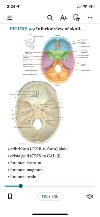 2 24 A A A Figure 9 9 Inferior View Of Skull Cribriform Crib Ri Form Plate Crista Galli Cris Ta Gal Li 1
