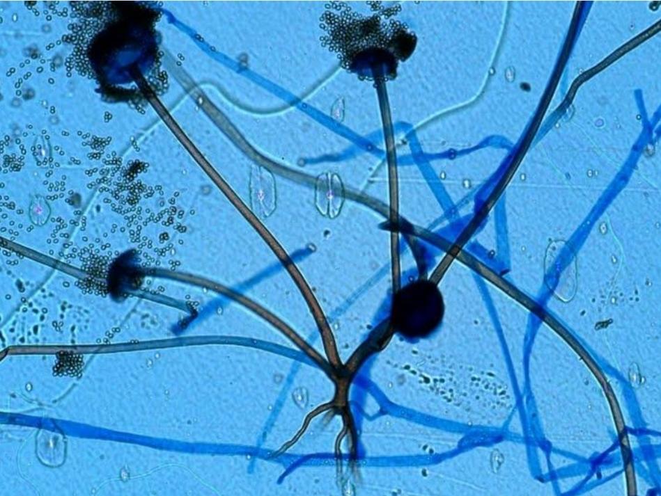 Write A Paragraph Describing Your Observation Of The Characteristics Organism Microscopes Rhizopus Spp 1