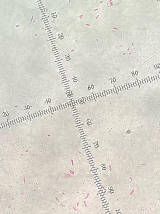 Its Gram Negative Escherichia Coli Serratia Marcescens Salmonella E Aerogenes P Vulgaris P Aeruginosa 2