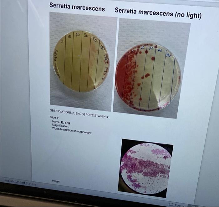 Observations 1 Effect Of Uv Radiation A Enter Your Data Below Score The Relative Amount Of Growth On Each Plate And 2