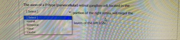The Axon Of A P Type Parvocellular Retinal Ganglion Cell Located In The Select Portion Of The Right Retina Will Targ 1