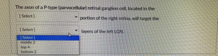 The Axon Of A P Type Parvocellular Retinal Ganglion Cell Located In The Select Portion Of The Right Retina Will Targ 2