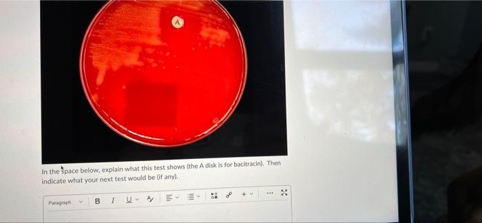 In The Pace Below Explain What This Test Shows The A Disk Is For Bacitracin Then Indicate What Your Next Test Would 1