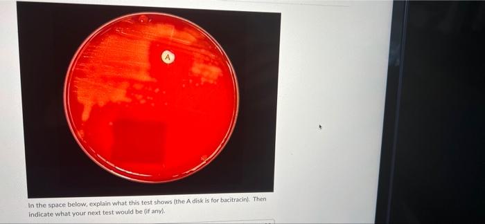 In The Space Below Explain What This Test Shows The A Disk Is For Bacitracin Then Indicate What Your Next Test Would 1
