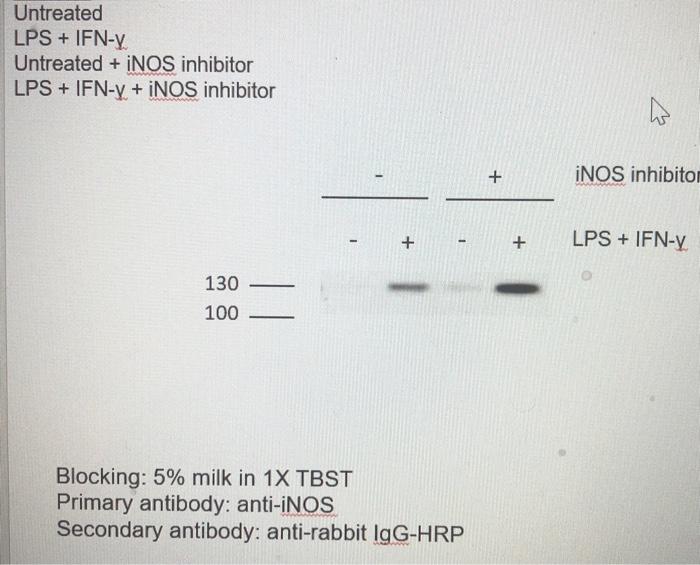 Untreated Lps Ifn Y Untreated Inos Inhibitor Lps Ifn Y Inos Inhibitor Inos Inhibitor Lps Ifn Y 130 100 B 1