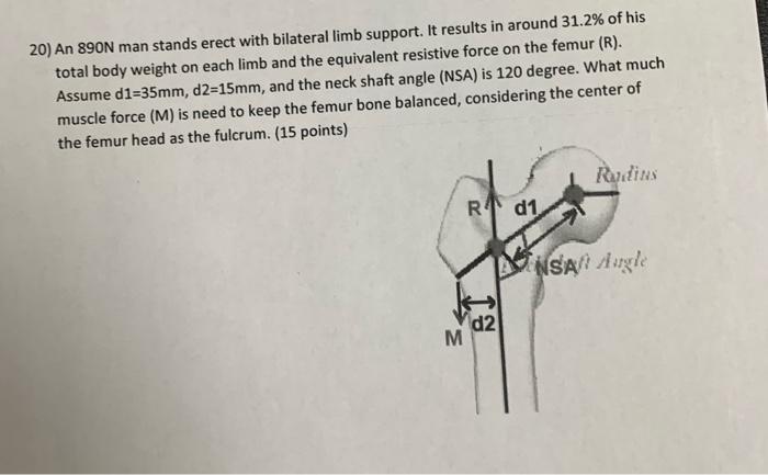 20 An 890n Man Stands Erect With Bilateral Limb Support It Results In Around 31 2 Of His Total Body Weight On Each Li 1