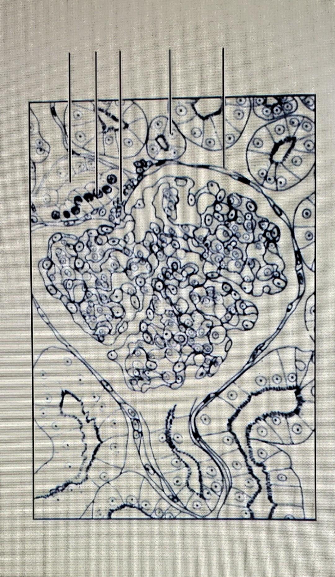 5 Label The Figure Using The Key Letters Of The Correct Terms Key A Juxtaglomerular Cells B Cuboidal Epithelium C 2