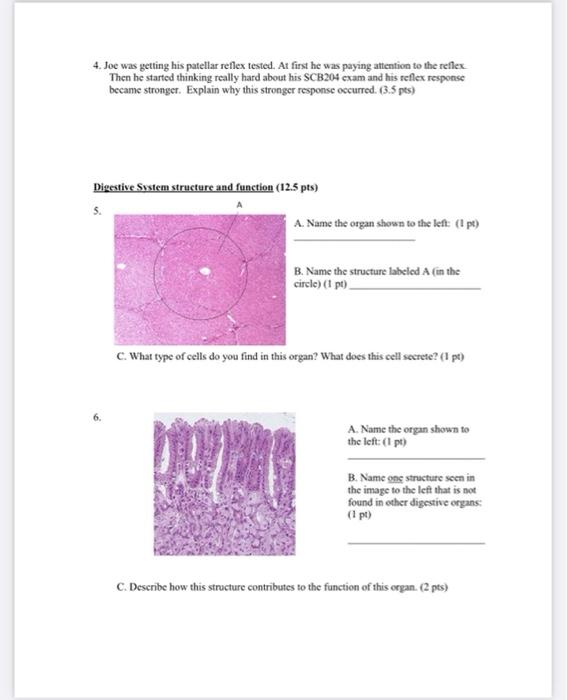 1 Identify The Following Components Of The Pupillary Light Reflex 0 5 Pts Each Sensory Receptor Sensory Nerve Conta 2