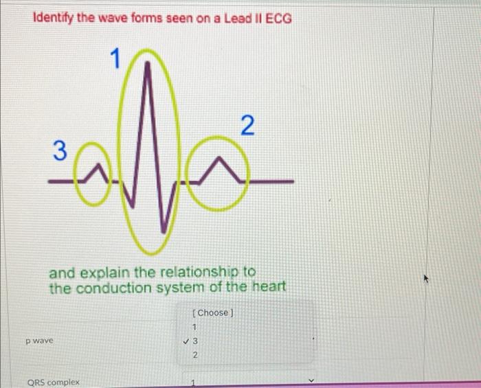 Identify The Wave Forms Seen On A Lead Ii Ecg 1 2 3 And Explain The Relationship To The Conduction System Of The Heart 1