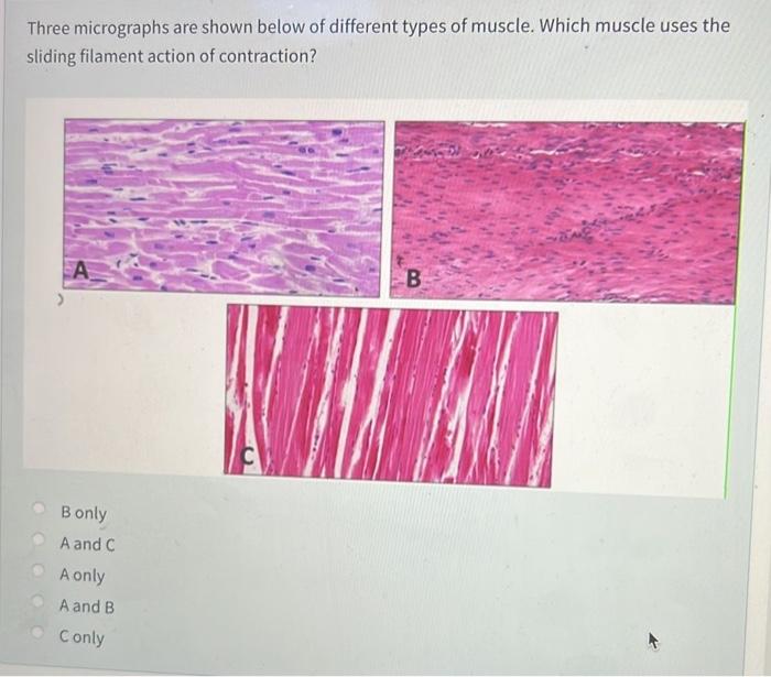 Where Are T Cells That Are Reactive To Self Antigen Removed O A Cortex Of The Thymus O B Medulla Of The Thymus Oc Whi 2