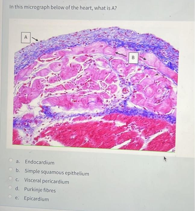 Where Are T Cells That Are Reactive To Self Antigen Removed O A Cortex Of The Thymus O B Medulla Of The Thymus Oc Whi 4