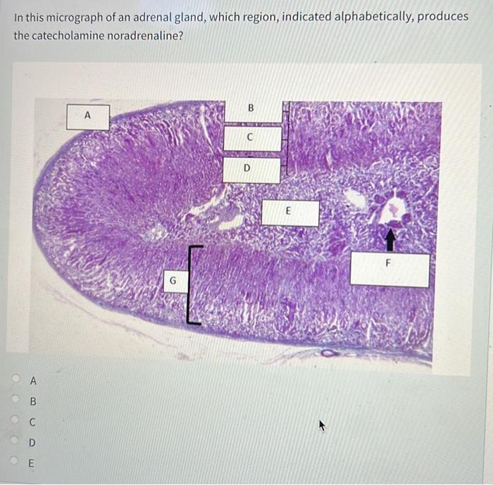 Where Are T Cells That Are Reactive To Self Antigen Removed O A Cortex Of The Thymus O B Medulla Of The Thymus Oc Whi 5
