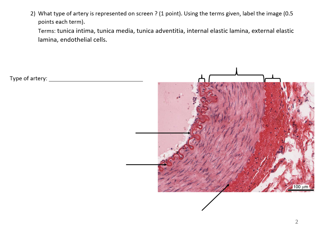 2 What Type Of Artery Is Represented On Screen 1 Point Using The Terms Given Label The Image 0 5 Points Each Ter 1