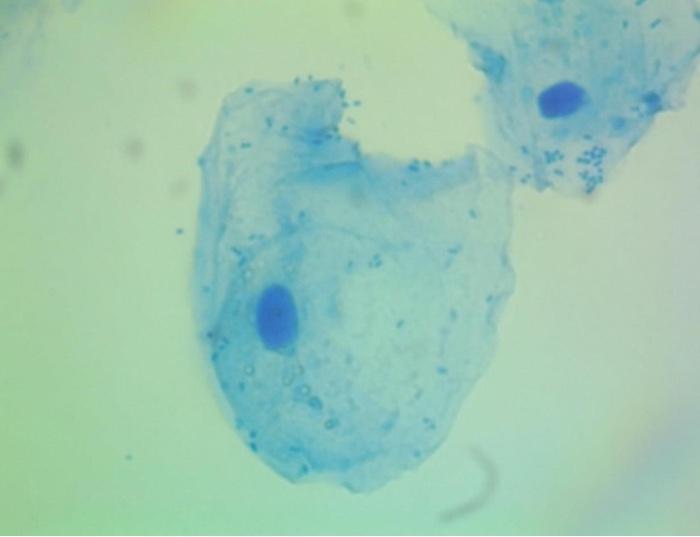 Can You Label Granules And Bacteria In The Imagine If There Is Some 1