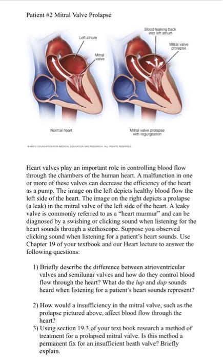 Patient 2 Mitral Valve Prolapse Blood Leaking Back Loftrum Mitral Valve Prolapse Miral Valve Normal Heart Malve Prolaps 1